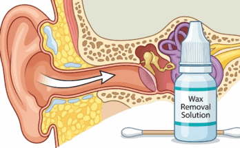 Wax Removal Aid Market
